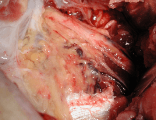 Intraoperative photograph showing radial nerve exploration in the posterior arm