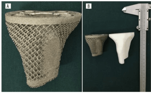 The final product made of titanium alloy. (A) The reticular porous structure on the surface. (B) Comparing with model made of photosensitive resin.