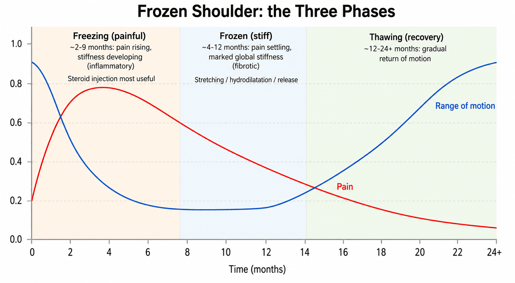 Graph of the three clinical phases of frozen shoulder showing pain and range-of-motion curves over time.