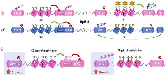 Diagram of maternal and paternal 11p15.5 imprinting centres IC1 and IC2