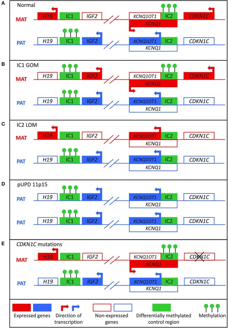 Molecular mechanisms of the major Beckwith-Wiedemann syndrome subtypes