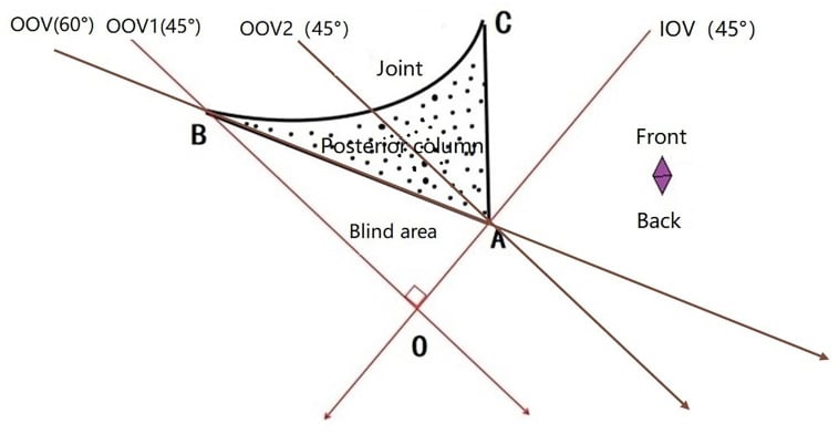 Axial schematic of the acetabulum at the level of the femoral head showing the 45 degree obturator oblique and iliac oblique imaging planes and the blind area between them