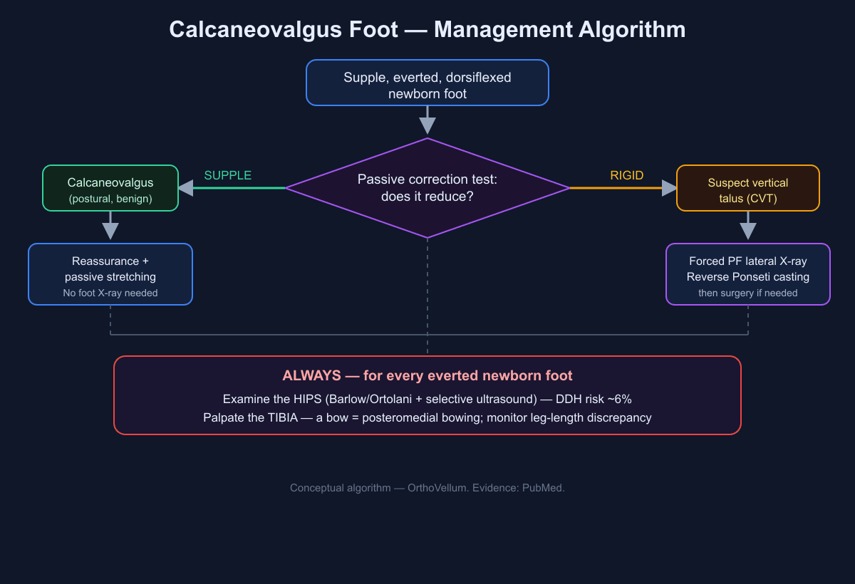 Flow diagram: supple everted newborn foot leads to passive correction test; if supple, reassure and stretch and check hips and tibia; if rigid, image and treat as congenital vertical talus.