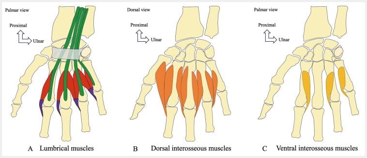 Schematic of the lumbrical and interosseous muscles of the hand