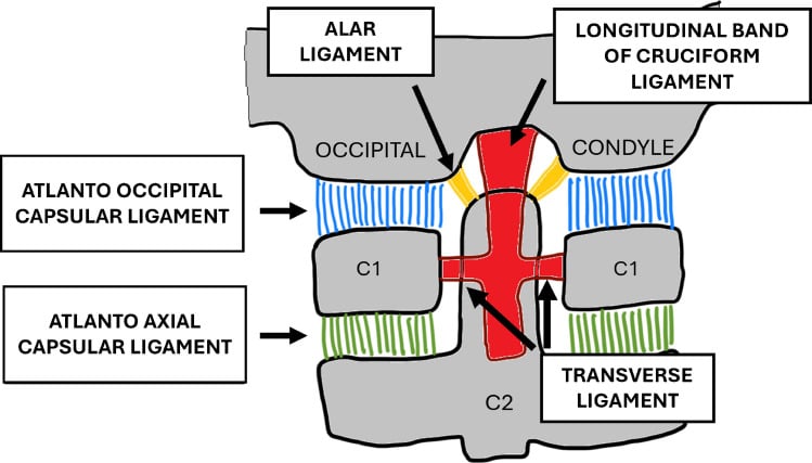 Coronal schematic of the craniocervical junction labelling the alar ligaments, longitudinal band of the cruciform ligament, transverse ligament and atlanto-occipital and atlanto-axial capsular ligaments
