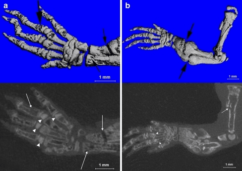 CT scan demonstrating orthopaedic application of computed tomography with cross-sectional bone detail