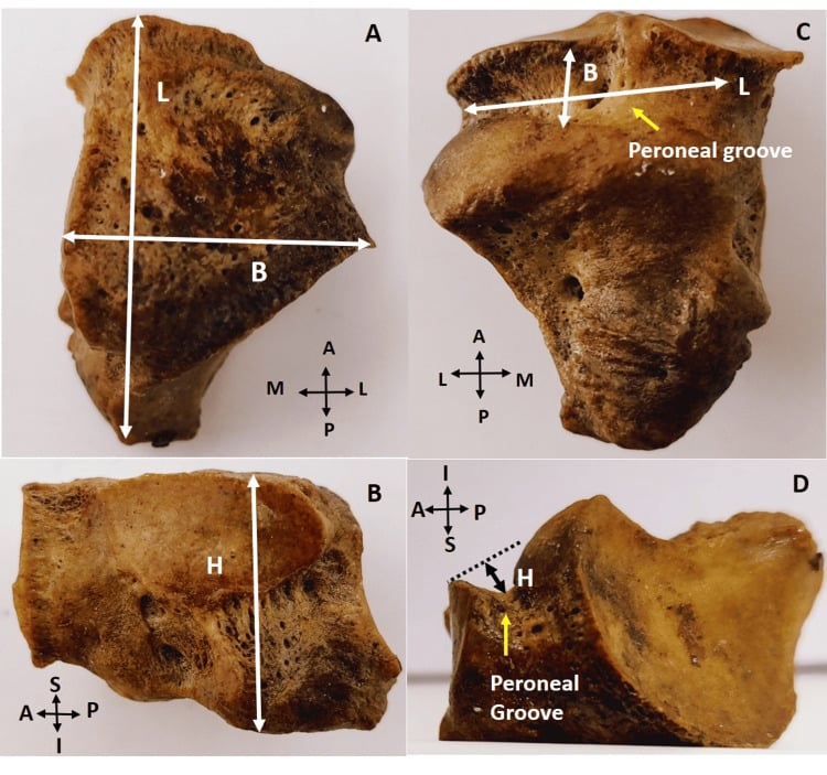 Four views of a dry cuboid, panels A to D, with orientation markers, measurement arrows labelled L, B and H, and the peroneal groove labelled in panels C and D