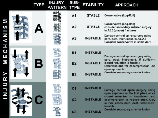 Spine trauma classification with DCO approach recommendations