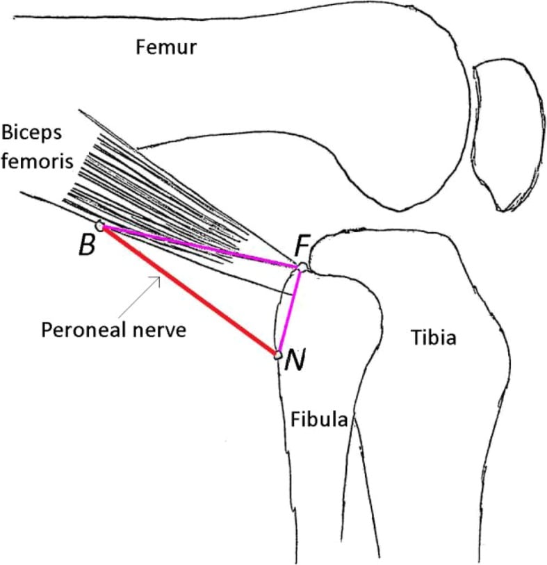Schematic of fibular head, biceps femoris and fibular-neck landmarks for the common peroneal nerve