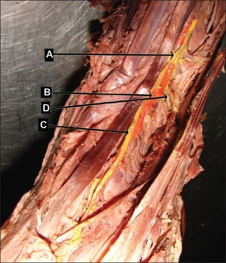 Painted cadaver dissection showing variable crossing of deep fibular nerve and dorsalis pedis artery
