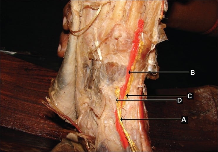 Painted cadaver dissection showing medial terminal deep fibular nerve medial to dorsalis pedis artery