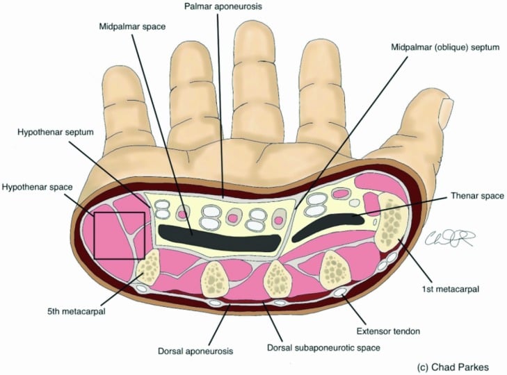 Cross-sectional anatomy of thenar midpalmar and hypothenar spaces