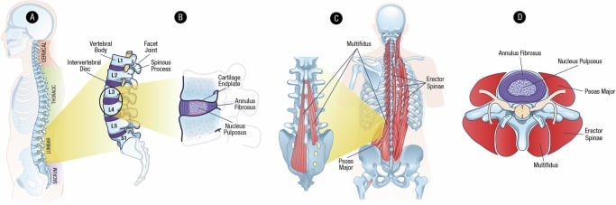 Four-panel diagram of lumbar spine, intervertebral disc, paraspinal muscles and axial vertebral anatomy