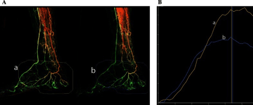 Angiographic images of tibial arteries and foot collateral flow before and after vasodilator