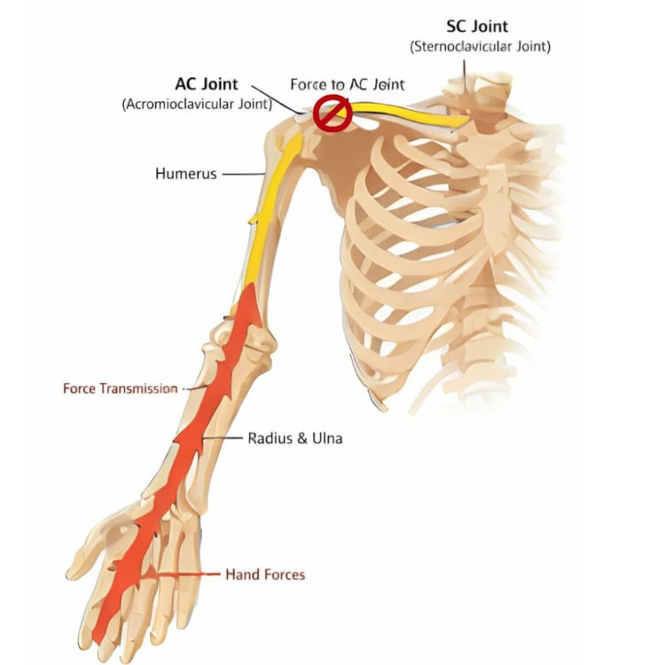 Illustration of force transmission from the hand through the upper limb to the acromioclavicular and sternoclavicular joints