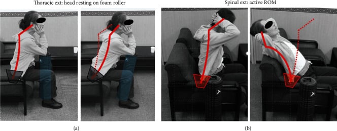 Phase three dropped head rehabilitation showing supported thoracic extension and submaximal active spinal extension
