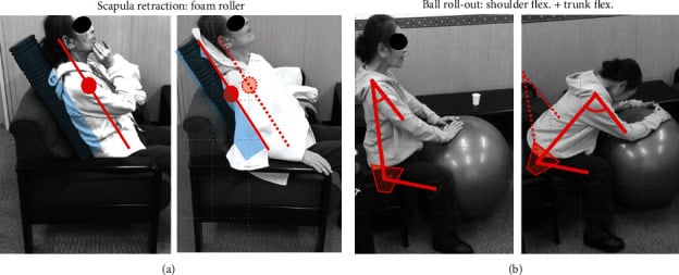 Phase two dropped head rehabilitation showing scapular retraction and supported ball roll-out exercises