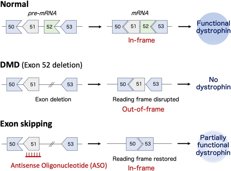 Schematic showing exon 52 deletion disrupting the dystrophin reading frame and antisense exon skipping restoring an in-frame transcript.