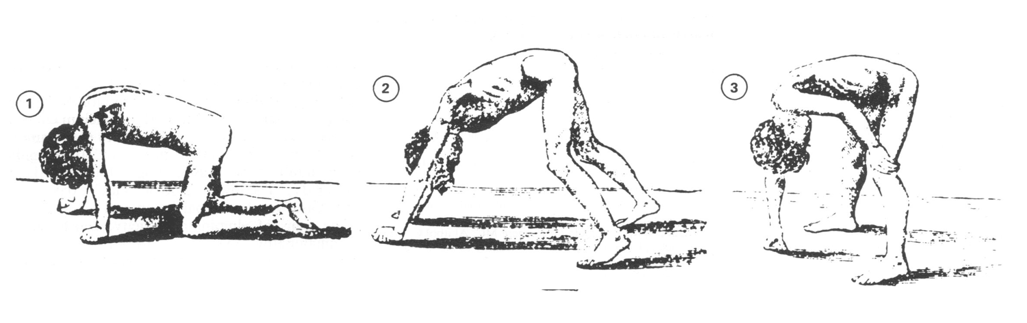 Gowers' sign: sequential drawings of a boy rising from the floor by walking his hands up his legs
