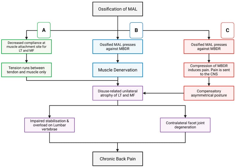 Axial CT scan demonstrating radiofrequency ablation needle positioning along the medial branch course