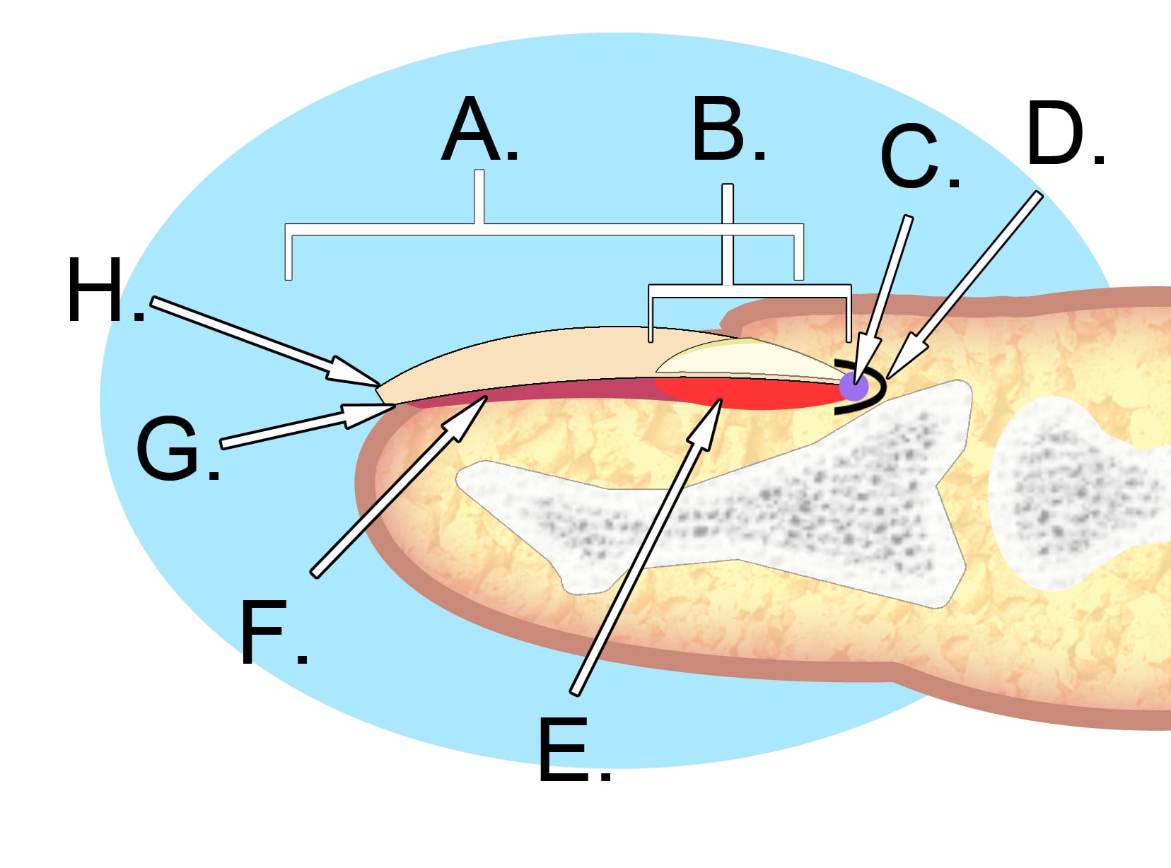 Sagittal cross-section diagram of the nail unit (perionychium) showing nail plate, germinal and sterile matrix, nail bed and distal phalanx.