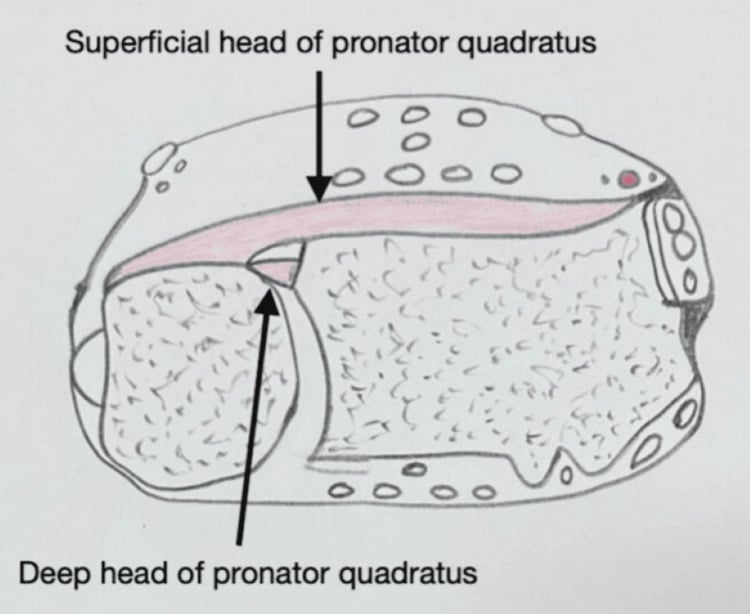 Anatomical diagram of pronator quadratus superficial and deep heads