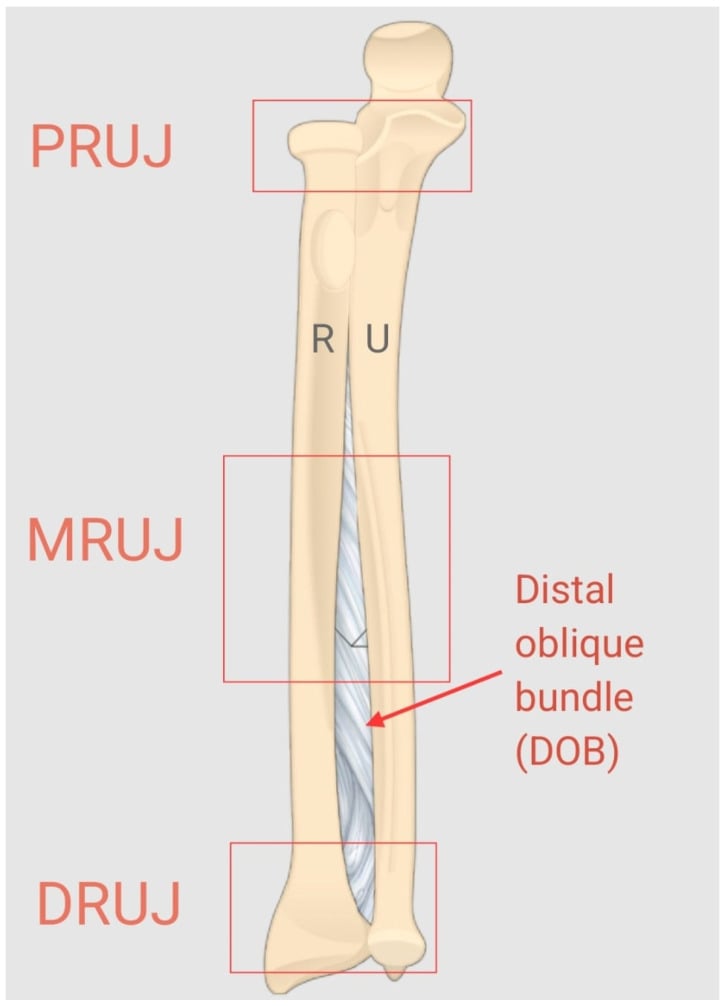 Anatomical diagram of forearm interosseous membrane and distal oblique bundle