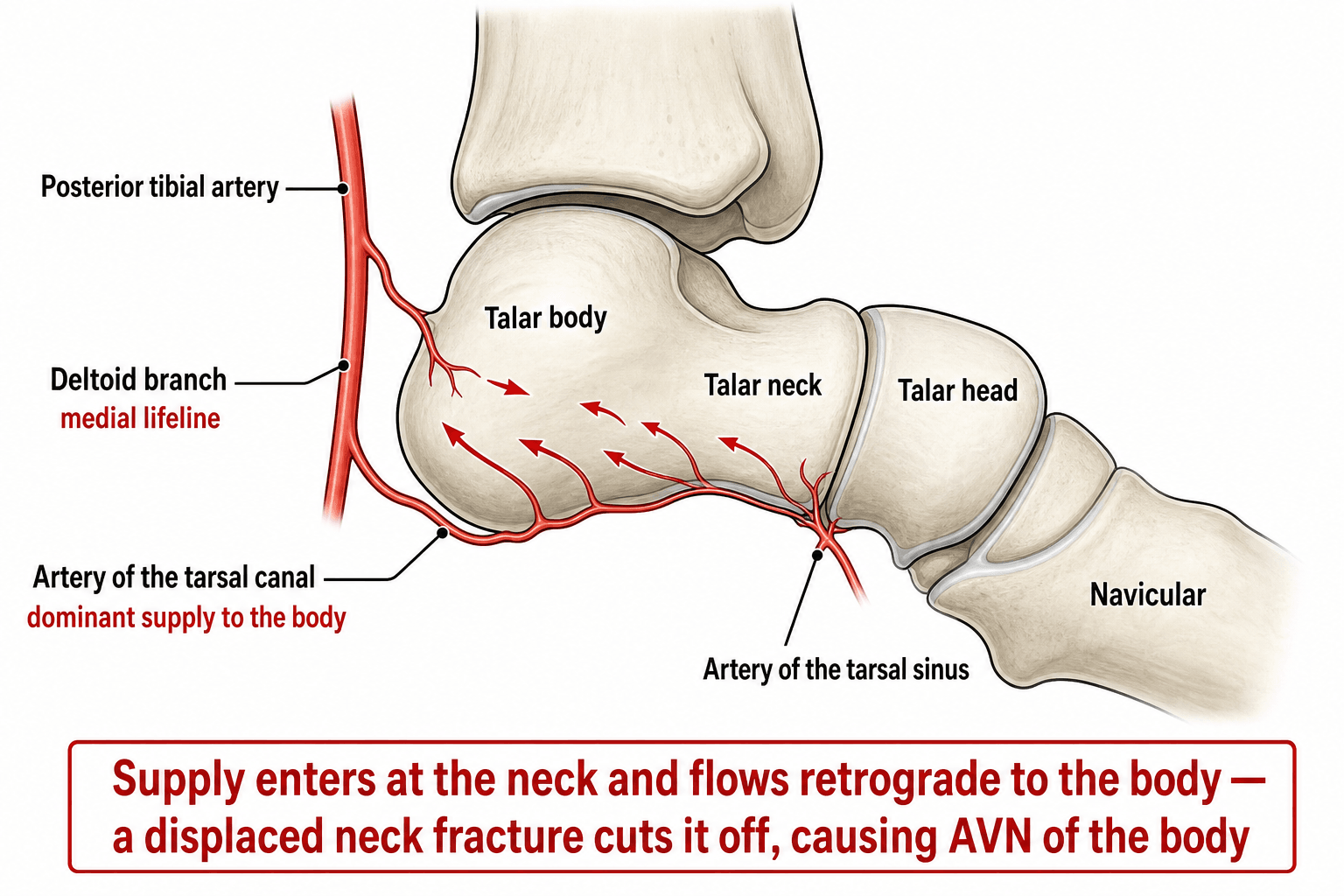Sagittal schematic of the talus showing the posterior tibial artery, artery of the tarsal canal, deltoid branch and artery of the tarsal sinus supplying the talar body retrograde through the neck.
