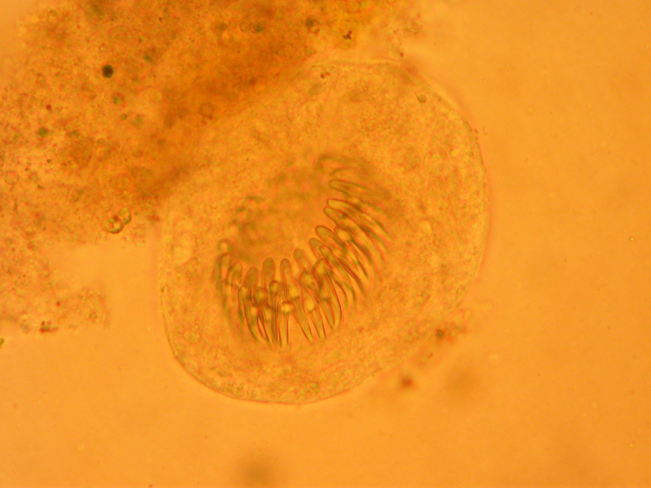 Light microscopy of hydatid cyst fluid showing a rounded protoscolex of Echinococcus granulosus with a visible circle of hooklets.