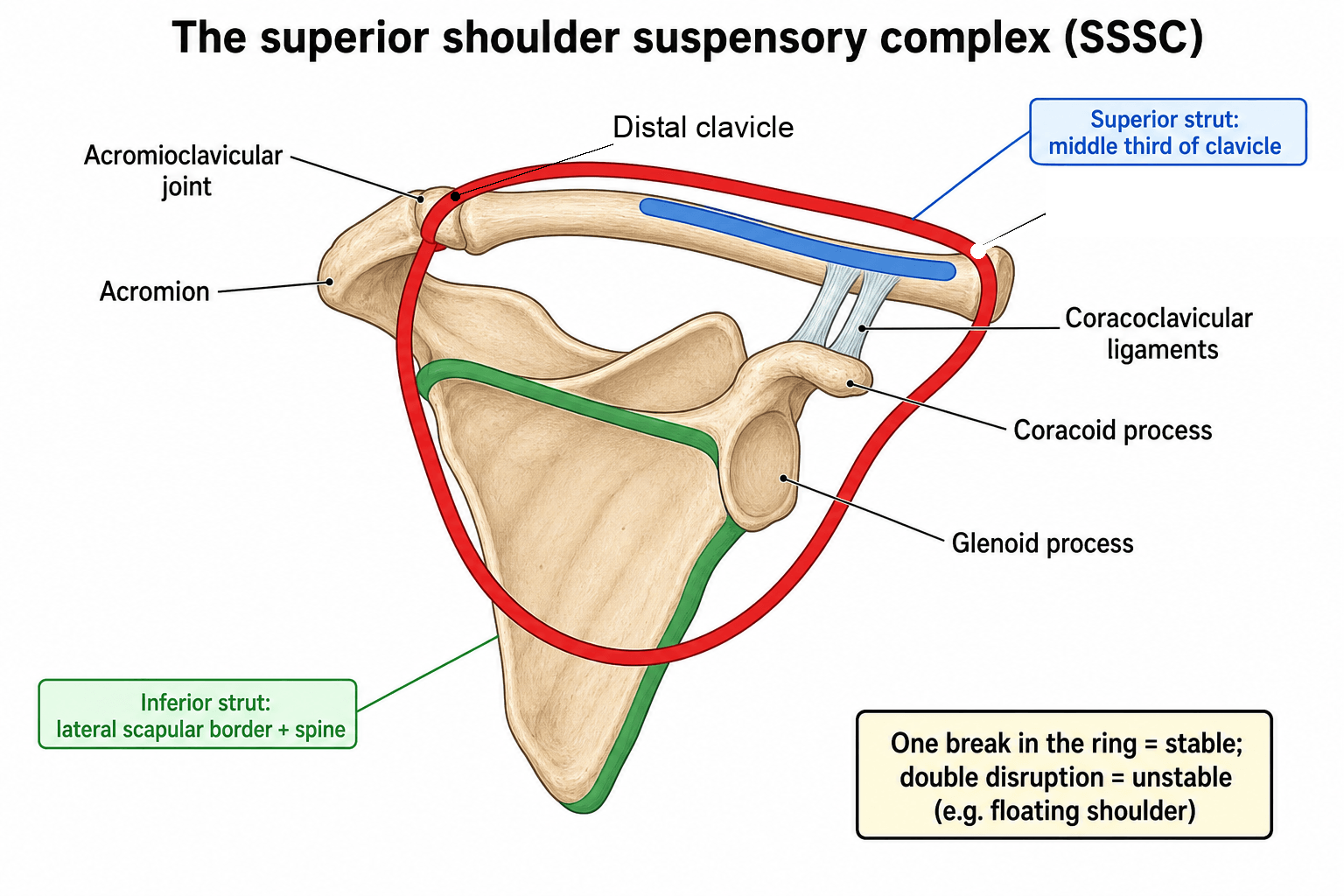 Diagram of the superior shoulder suspensory complex: a ring through the glenoid, coracoid, coracoclavicular ligaments, distal clavicle, AC joint and acromion, suspended by a superior strut (mid-clavicle) and an inferior strut (lateral scapular border and spine)