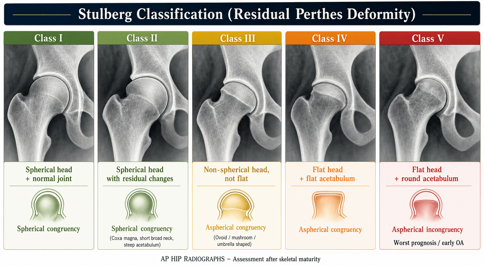 Stulberg classification of residual Perthes deformity
