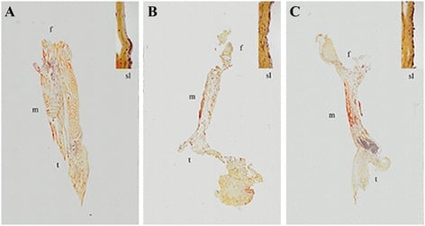Histologic cross-sections of ACL healing with different repair techniques