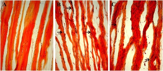 Collagen fiber organization in normal vs healing ACL tissue