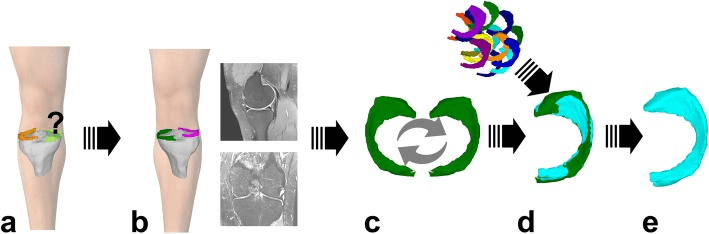 Workflow of contralateral 3D MRI meniscal allograft matching, panels a to e