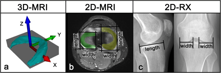 Meniscal dimensions measured by 3D MRI, 2D MRI and plain radiographs, panels a to c