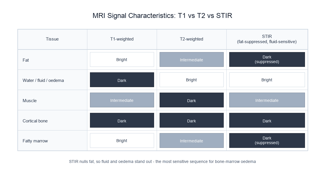Table of MRI signal characteristics of fat, fluid, muscle, cortical bone and marrow on T1, T2 and STIR