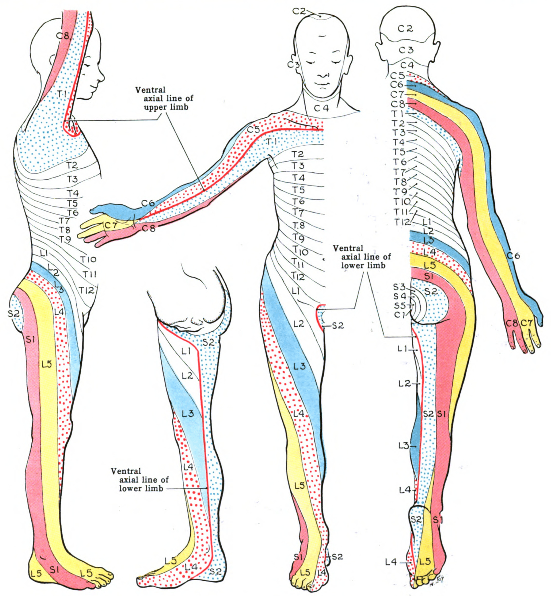 Full-body dermatome map showing the cutaneous sensory territory of each spinal nerve root from C2 to S5.