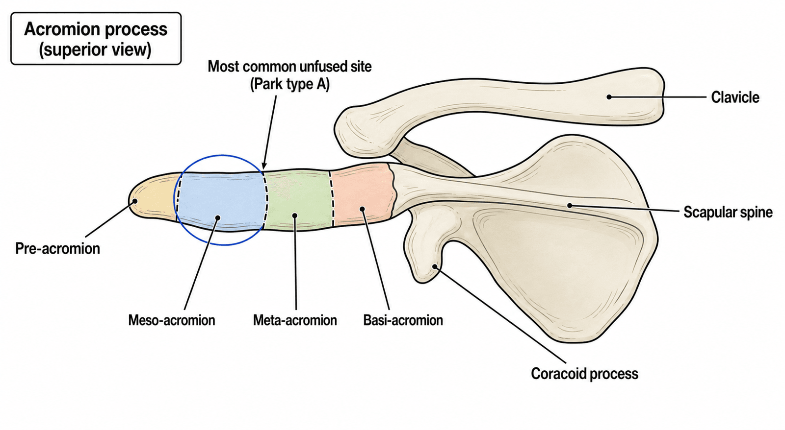 Schematic superior view of the acromion process divided into pre-, meso-, meta- and basi-acromion segments, with the meso-meta junction marked as the most common unfused site (Park type A)