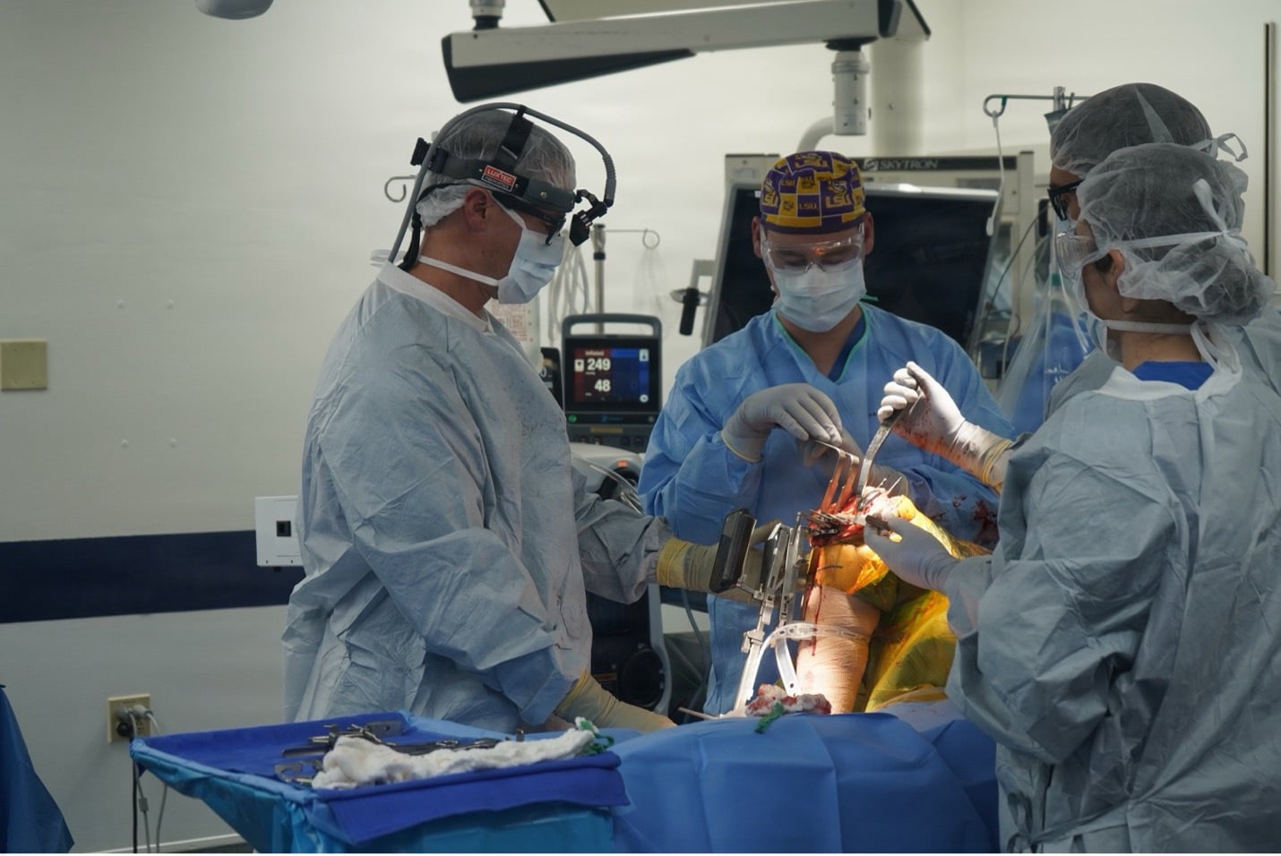 Surgical team performing computer-assisted knee replacement, with a navigation/tracking frame on the limb and a navigation monitor in the background.