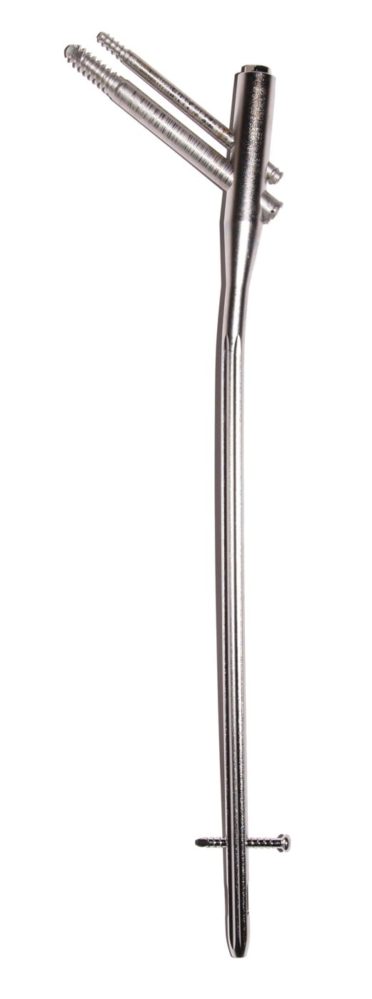 Photograph of a proximal femoral reconstruction-type cephalomedullary nail with two proximal head/neck screws and a distal interlocking screw.