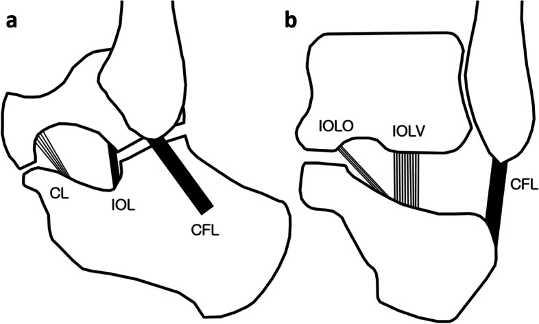 Two-panel schematic of the subtalar ligaments, labelled CL, IOL and CFL in panel a and IOLO, IOLV and CFL in panel b