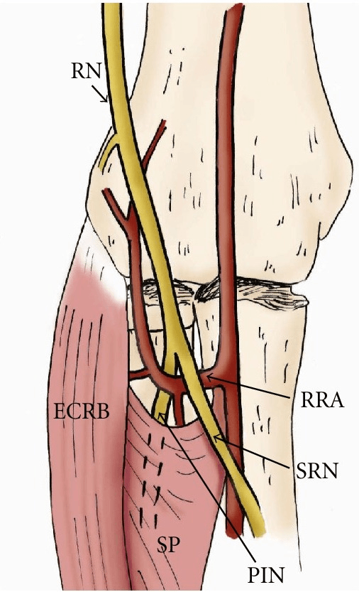 Anterior elbow diagram showing radial nerve division, radial recurrent artery, superficial radial nerve, posterior interosseous nerve and supinator