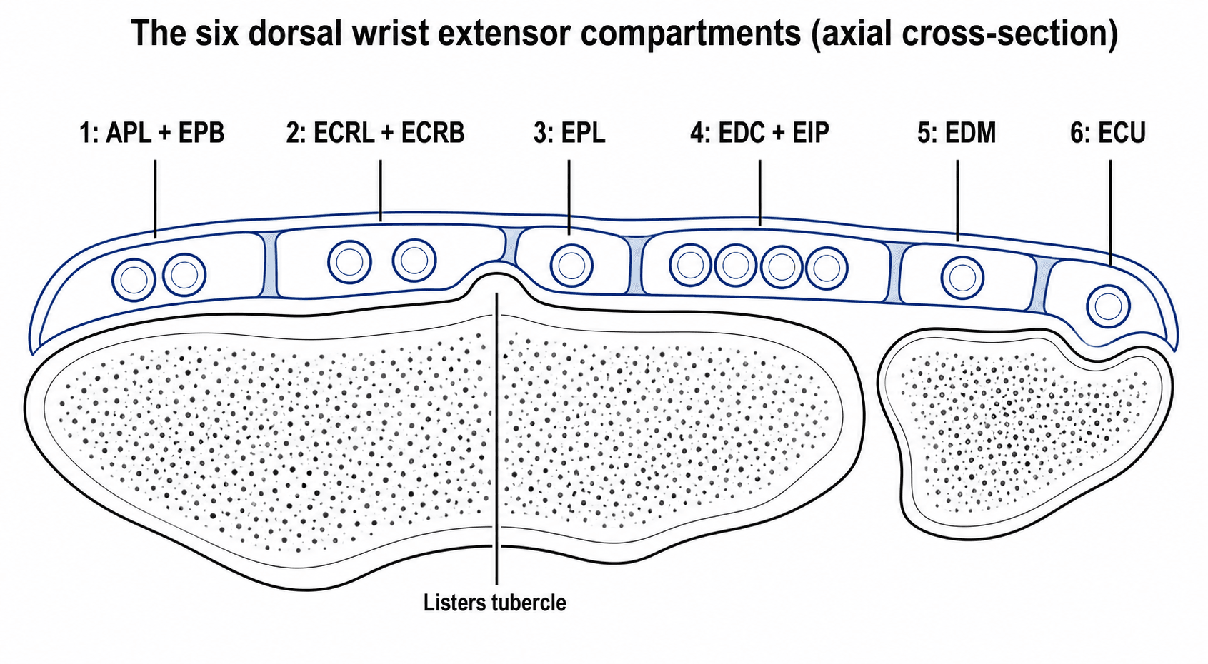 Axial cross-section diagram of the six dorsal wrist extensor compartments with their tendon contents and Lister's tubercle