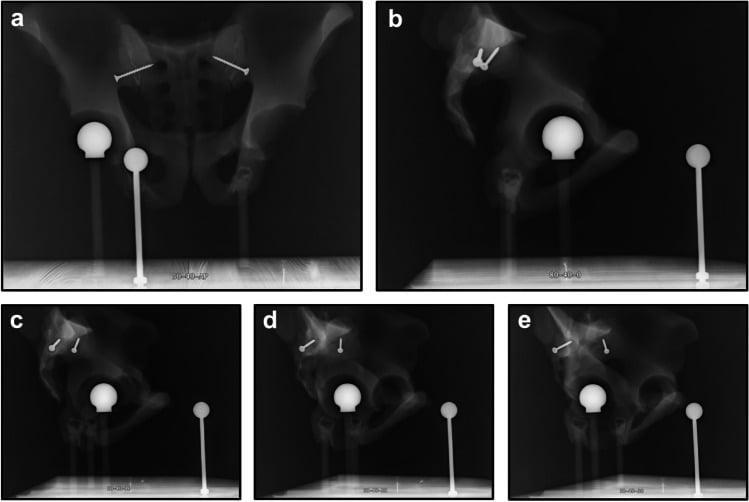 Phantom radiographs: an AP view of a pelvis phantom with a sphere at the hip and a calibration sphere on a stand, and four lateral views at increasing rotation