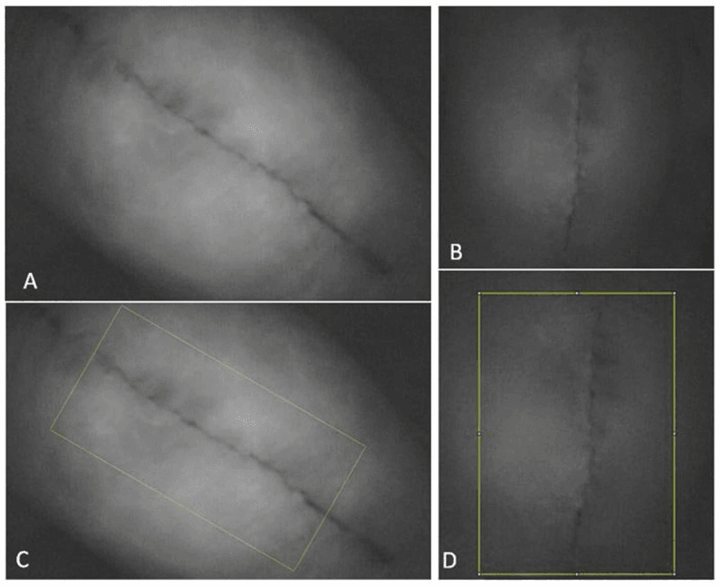 Indocyanine-green fluorescence images of an anterior knee incision before and after anterior icing, panels A-D, with yellow boxes outlining regions in C and D