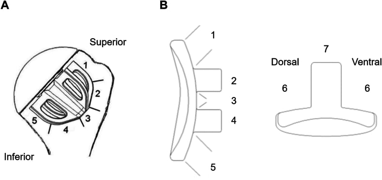 Schematics showing numbered humeral and glenoid radiolucency zones after anatomic TSA