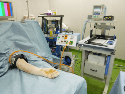 Intraoperative view of a draped patient with an upper limb extended on a hand table beside the tourniquet console