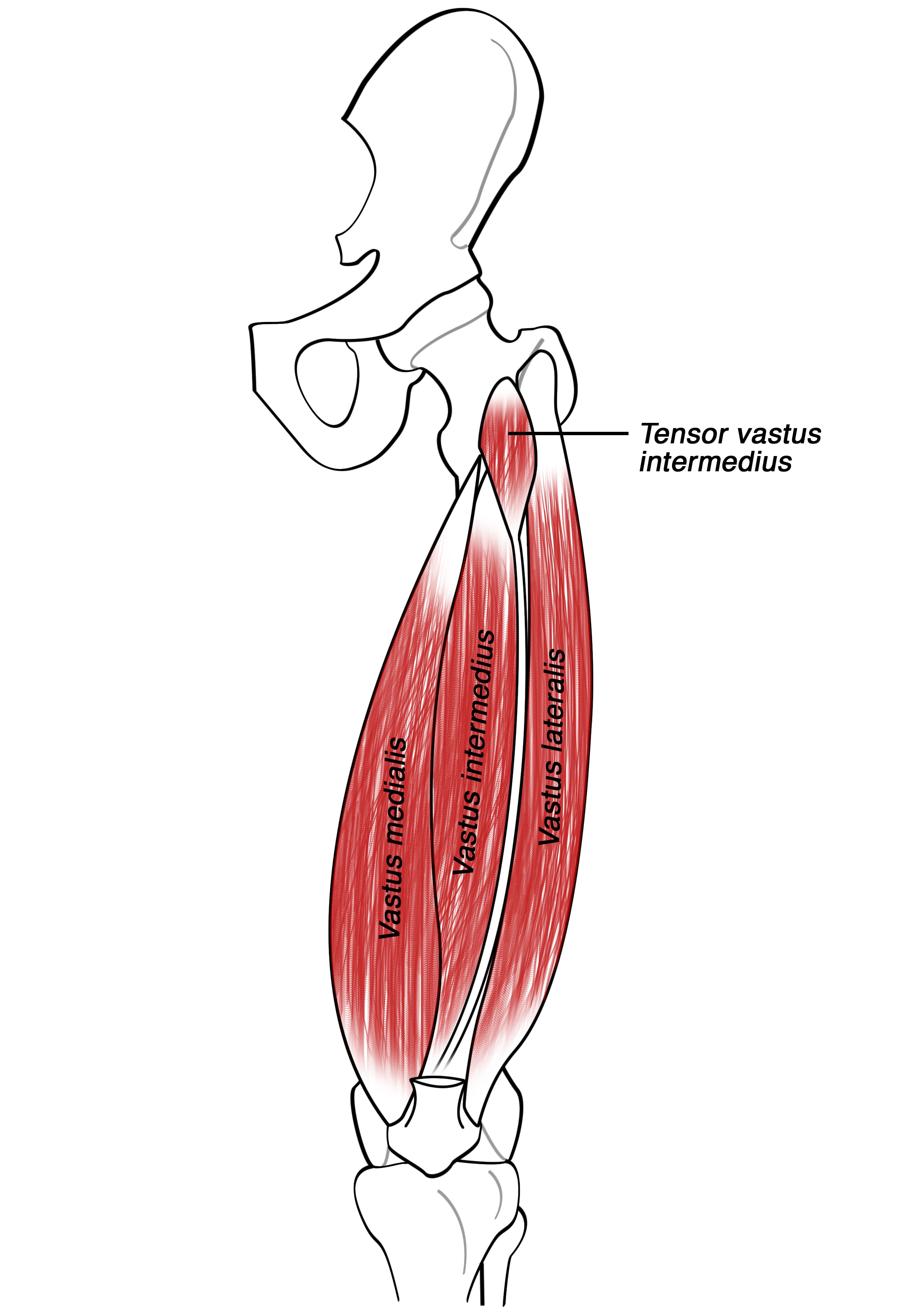3D reconstruction showing the tensor vastus intermedius at the anterolateral hip, between tensor fasciae latae and vastus lateralis.