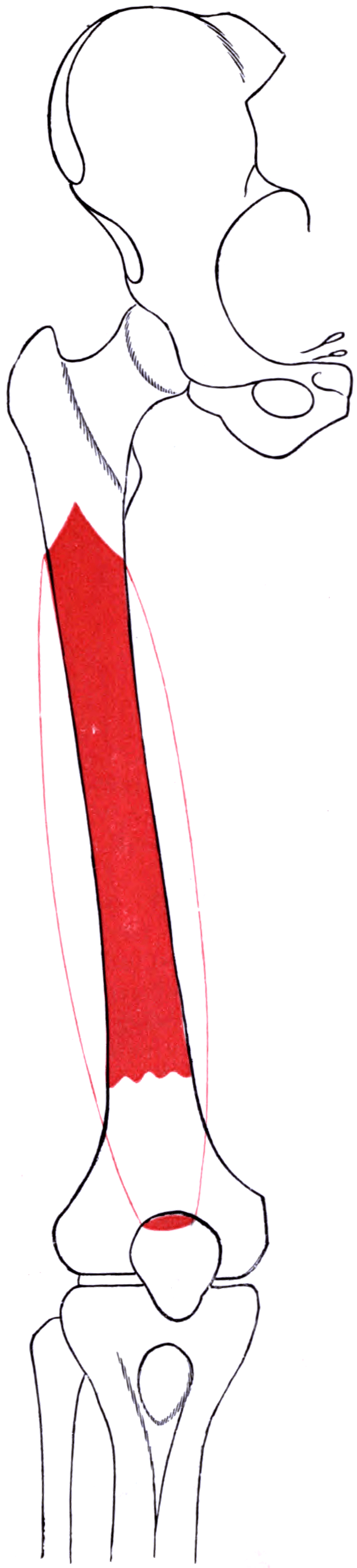 Outline of the right femur with the vastus intermedius origin and insertion marked in red.