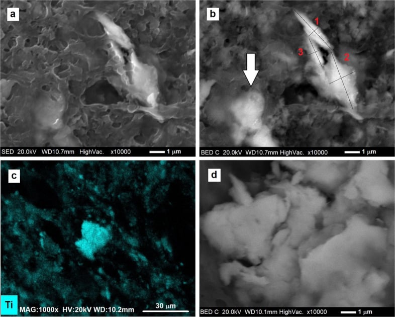 Four electron-microscopy panels (a-d): secondary and backscattered electron images at x10000 with 1 μm scale bars, and a titanium elemental map with a 30 μm scale bar, showing micron-scale titanium-rich wear debris in tissue.